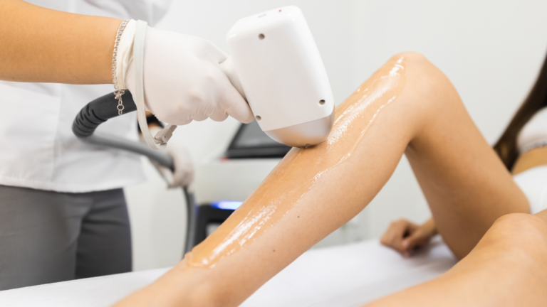 Laser hair removal treatment being performed on a patient's leg by a professional using an advanced device.