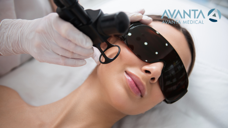 Close-up of a woman undergoing CO2 laser skin treatment with protective eyewear, performed by a professional using AVANTA Medical technology.