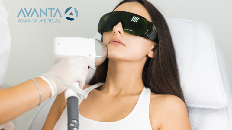 Professional laser hair removal treatment being performed on a woman's face using advanced equipment by AVANTA Medical.